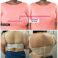 💖LAST DAY SALE 50% OFF💖Back Smoothing Bra with shapewear