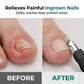 Professional 3-in-1 Pedicure Clipper Set ✅ Factory Direct Sales